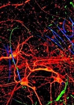 Neurons (orange) grow on a scaffold of silicon nanowires (green and blue).